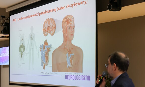 Zielona Góra miejscem rozmów o chorobach neurologicznych